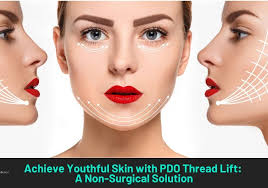 Why Is PDO Threading Popular in Non-Surgical Aesthetics?